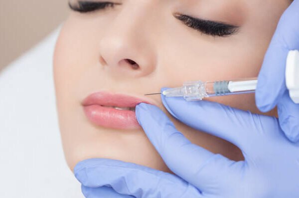 Can Russian Lip Fillers improve upper lip definition