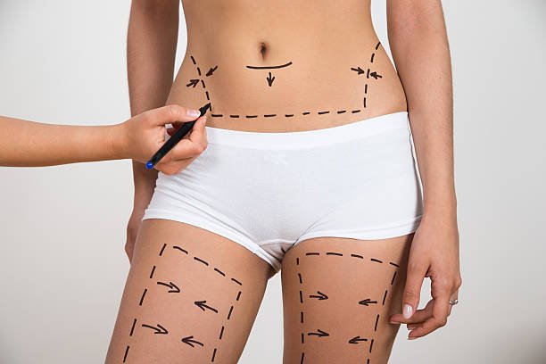 Can Sculpsure Body Contouring help shape the waist