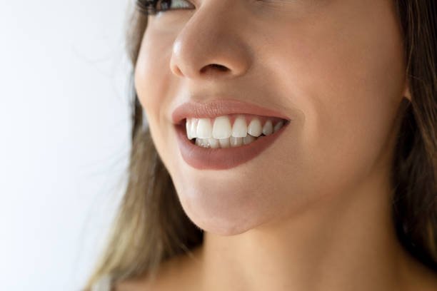 Can Teeth Whitening brighten teeth in one session