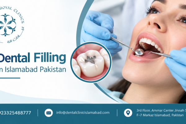 Dental Filling in Islamabad