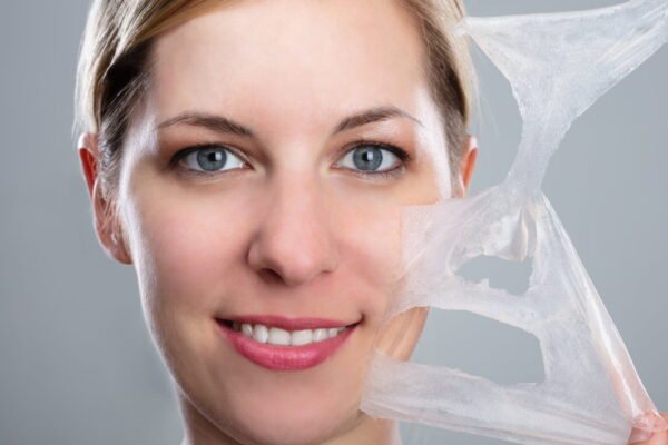Do Chemical Peels Improve Uneven Skin Tone