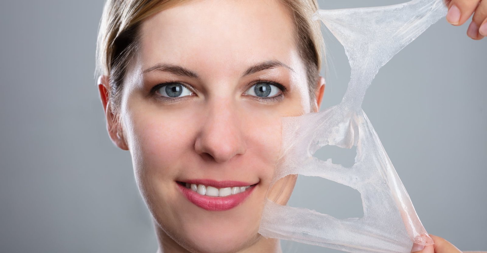 Do Chemical Peels Improve Uneven Skin Tone