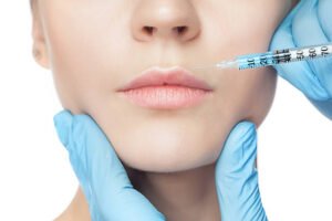 Do Lip Filler Injections complement facial fillers