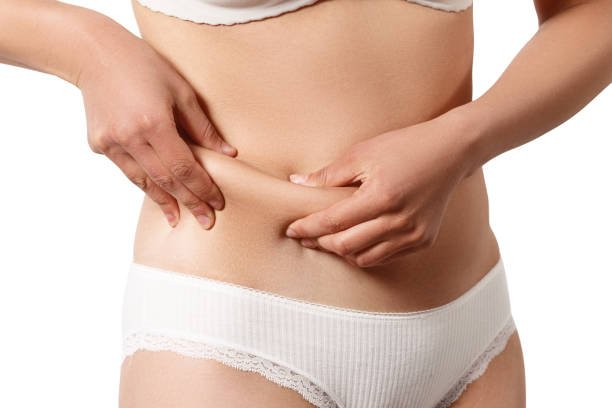 Does Fat Reduction help with persistent waistline fat