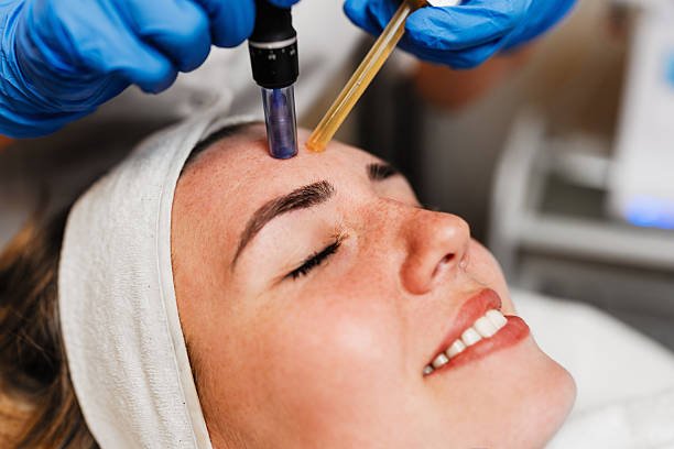 Does Fractional RF Micro Needling Help Sagging Skin