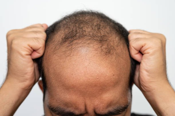 Does GFC Treatment for Hair Support New Hair Growth