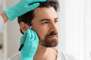 Hybrid Hair Transplant in Abu Dhabi