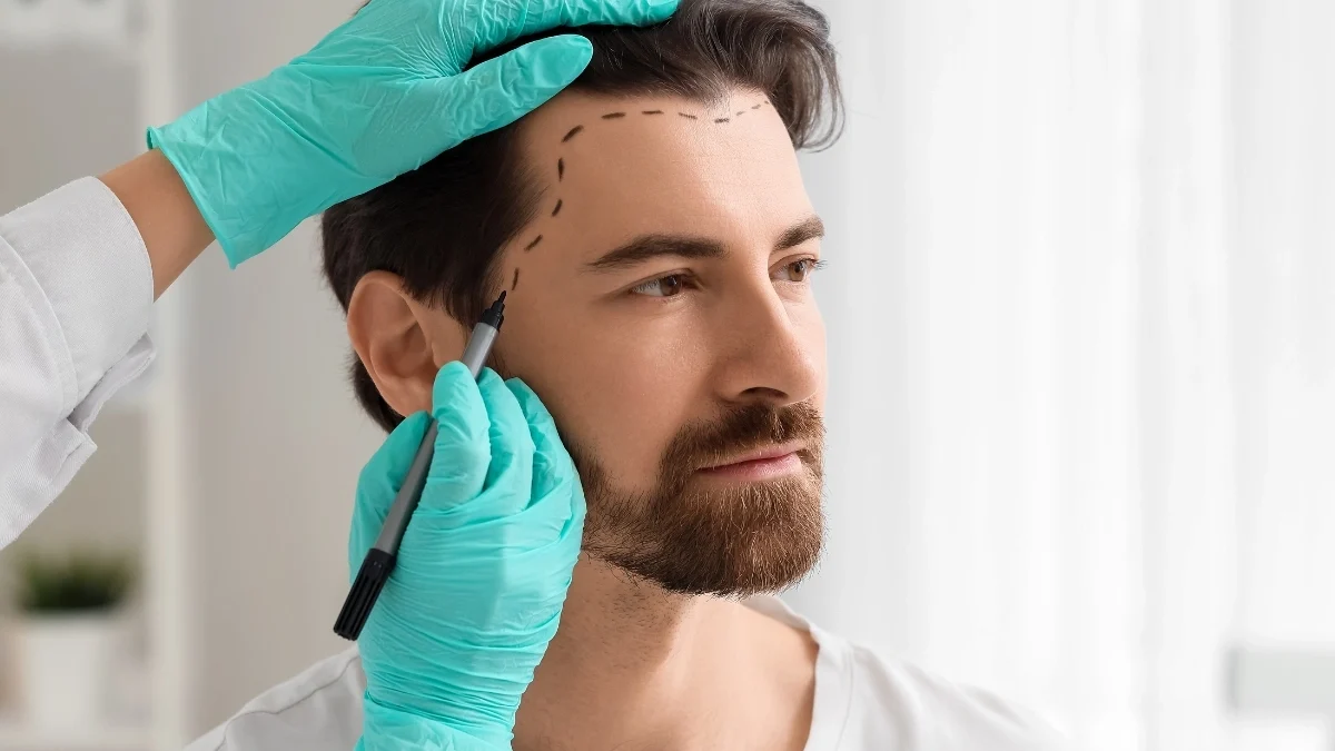 Hybrid Hair Transplant in Abu Dhabi