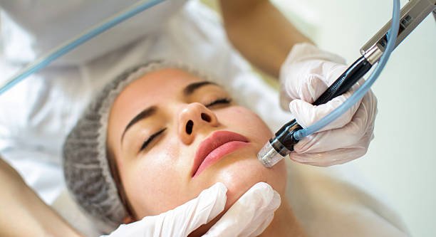 Does HydraFacial Help Remove Dead Skin Buildup