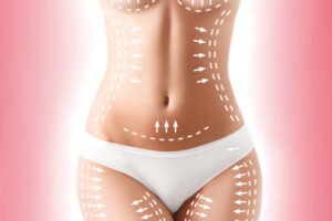 Does Lower Body Lift help improve buttock shape
