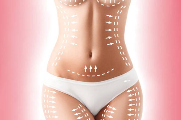 Does Lower Body Lift help improve buttock shape