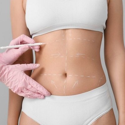 Fat Melting Injections