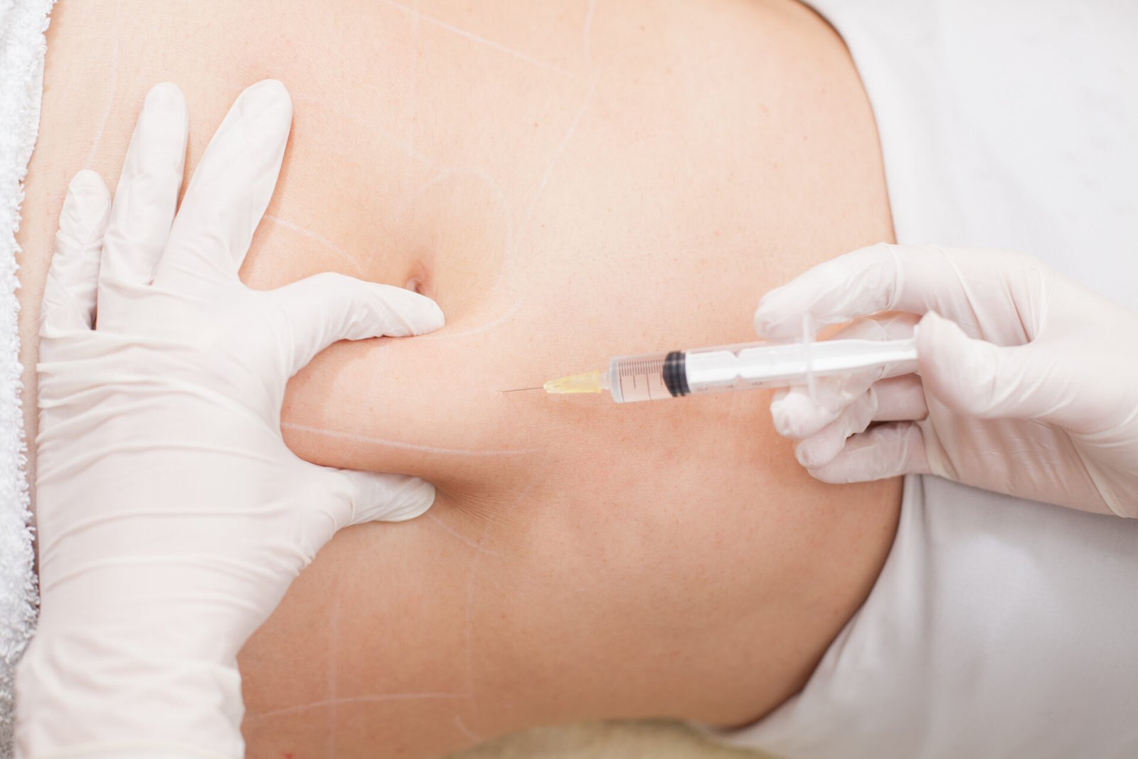 Fat Melting Injections in Abu Dhabi