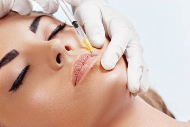 How Do Lip Filler Injections Add Lip Volume