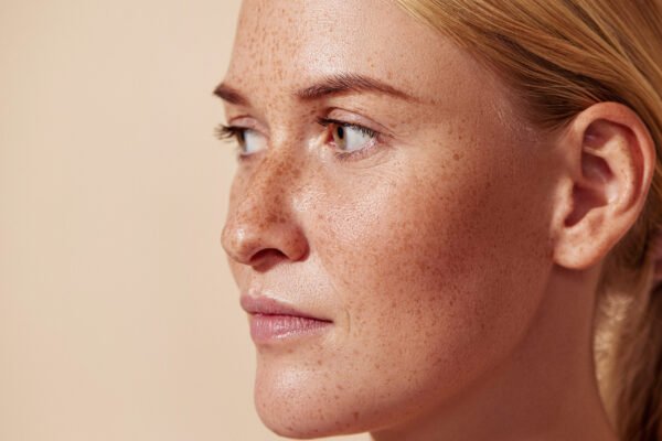 Dermal Pigmentation in Abu Dhabi