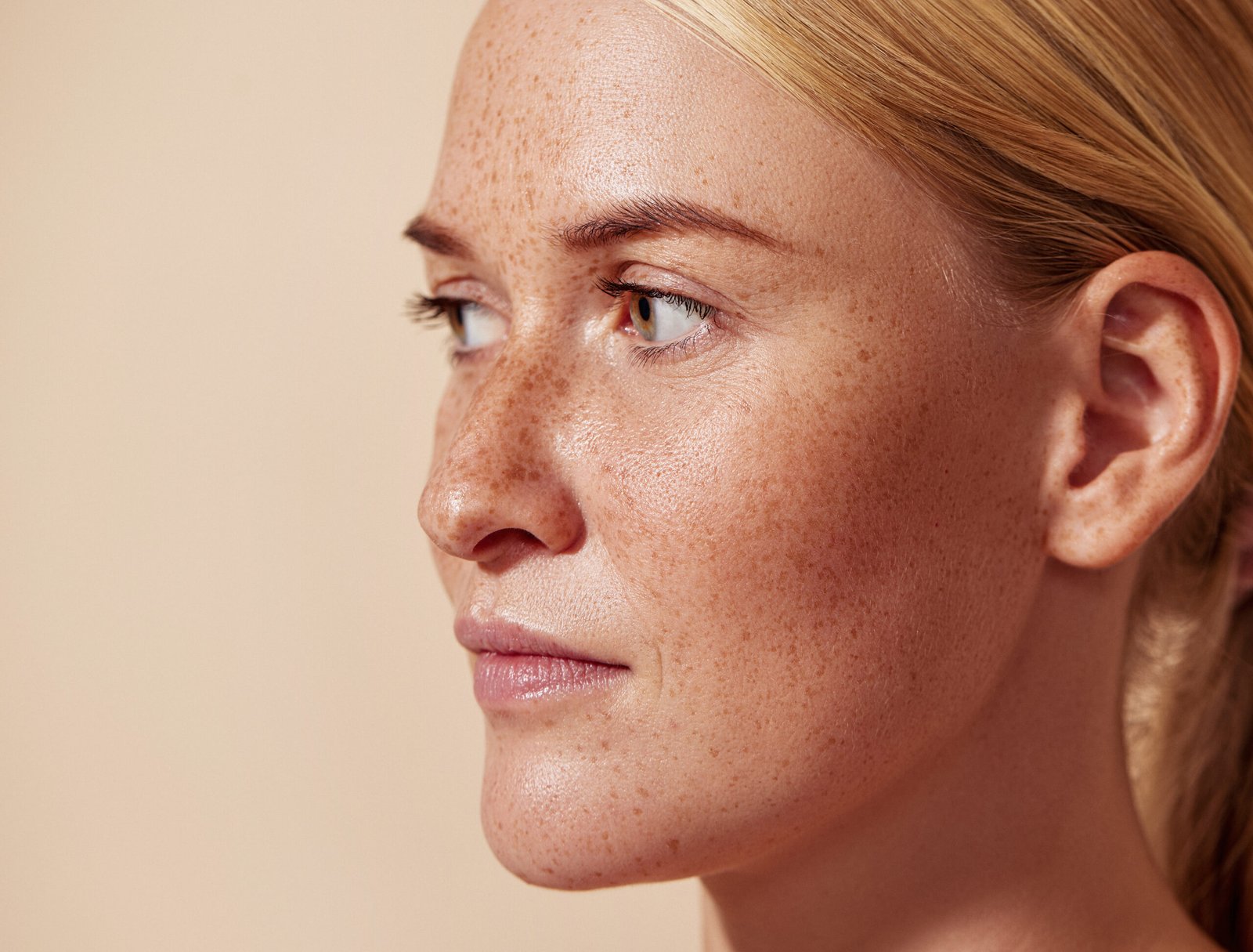 Dermal Pigmentation in Abu Dhabi