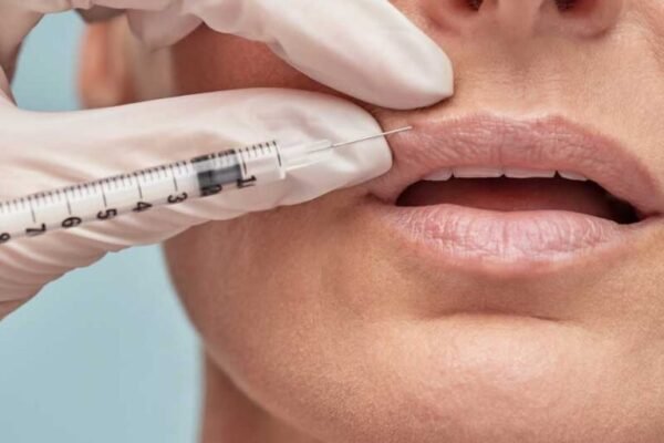 Smoker’s Lips Treatment in Abu Dhabi