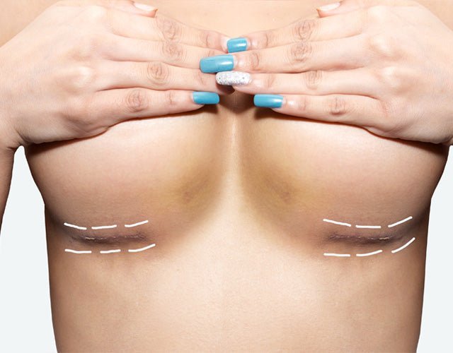 Breast Lift Surgery Abu Dhabi