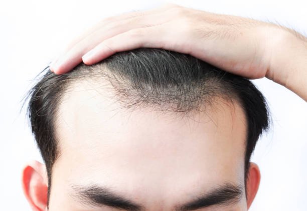 Is G Cell Treatment effective for thinning crown hair