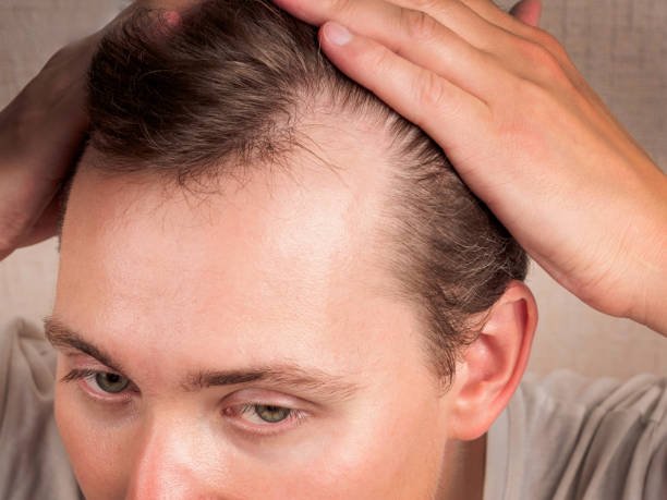 Is GFC Treatment for Hair useful for seasonal hair fall