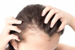 Hair Loss Treatment in Abu Dhabi