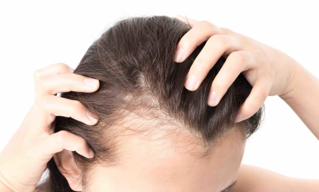 Hair Loss Treatment in Abu Dhabi