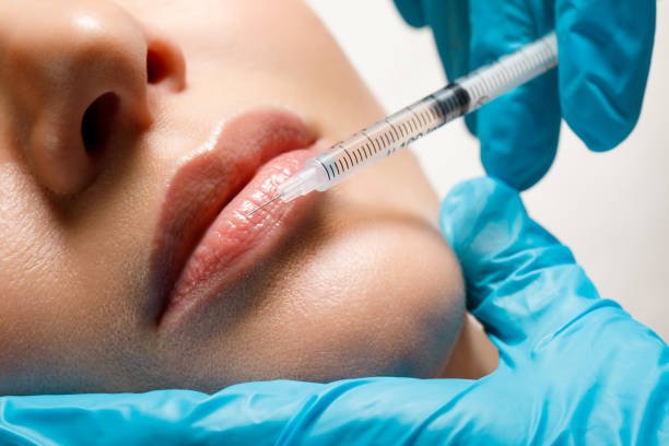 Is Lip Filler Injection suitable for asymmetric lips