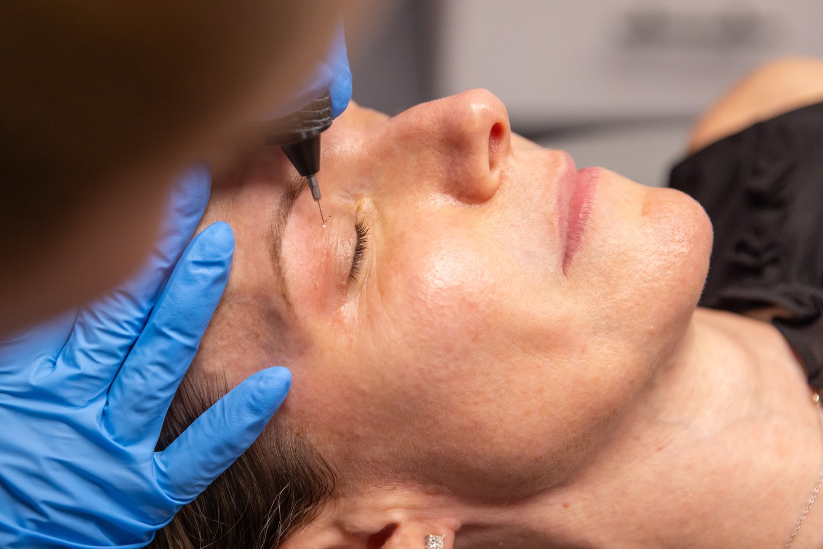 Plexr Plasma Eyelift in Abu Dhabi