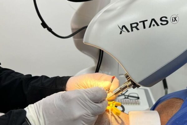 Robotic Hair Transplant in Abu Dhabi