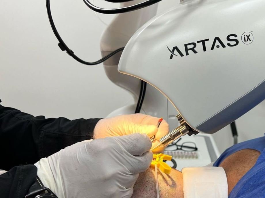Robotic Hair Transplant in Abu Dhabi