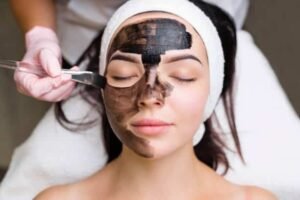 Spectra Laser Carbon Peel in Abu Dhabi