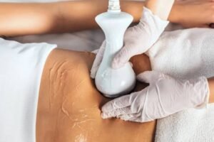 Laser Liposuction