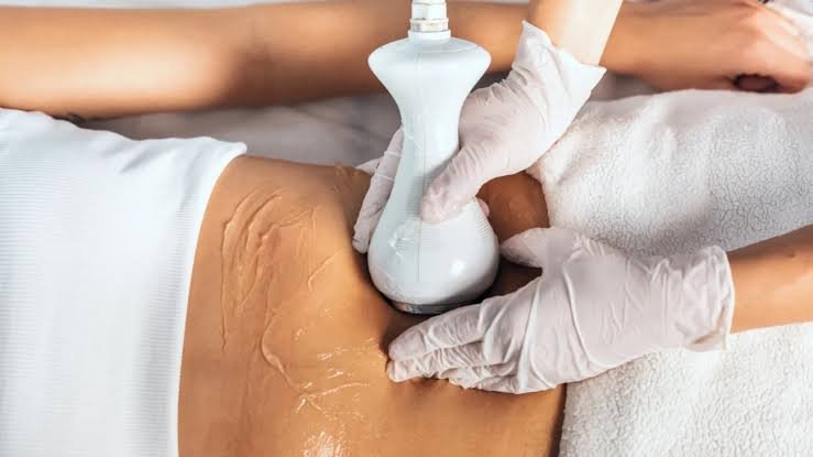 Laser Liposuction