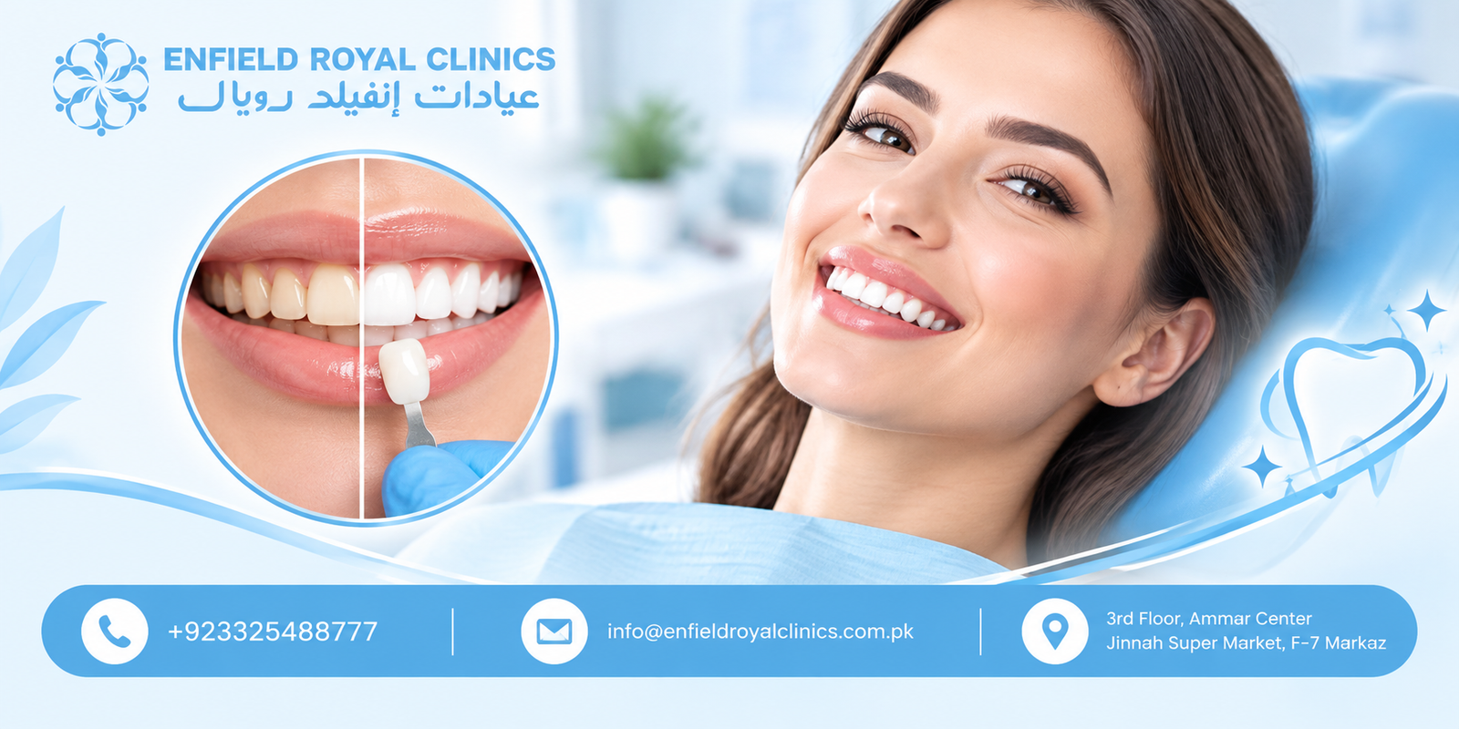Laser Teeth Whitening in Islamabad