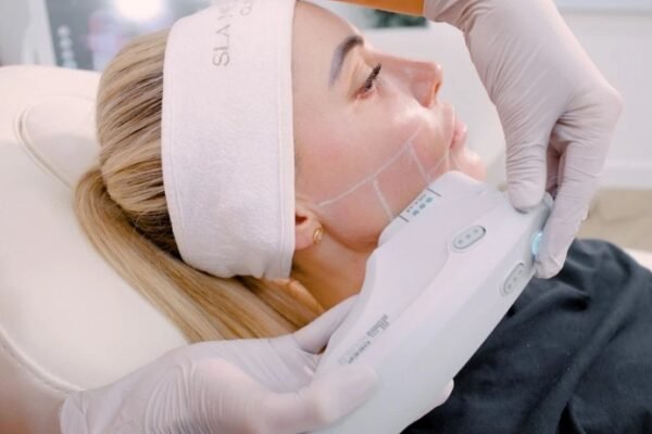 Skinvive Treatment in Manchester