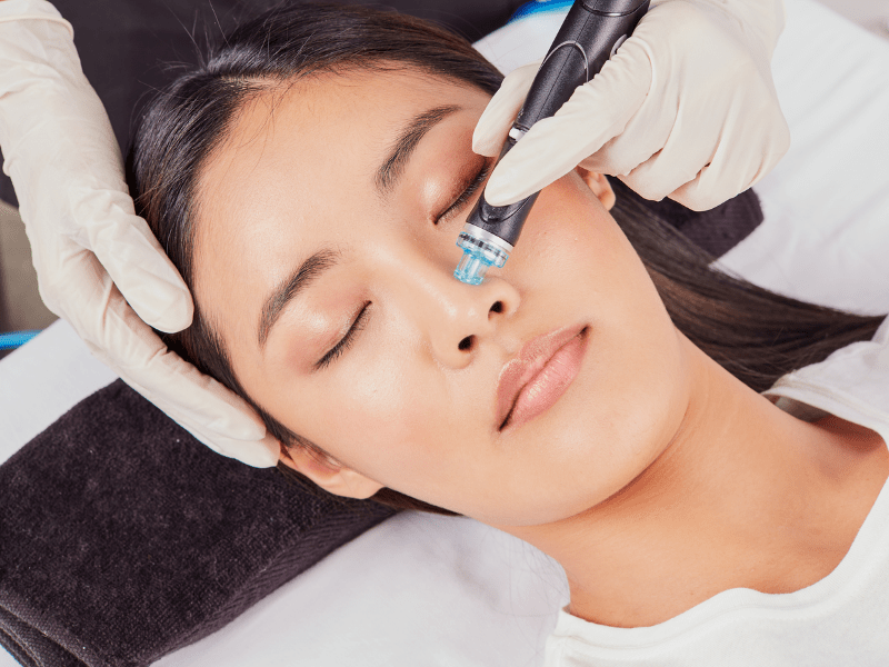 Dermapen treatment in Abu Dhabi