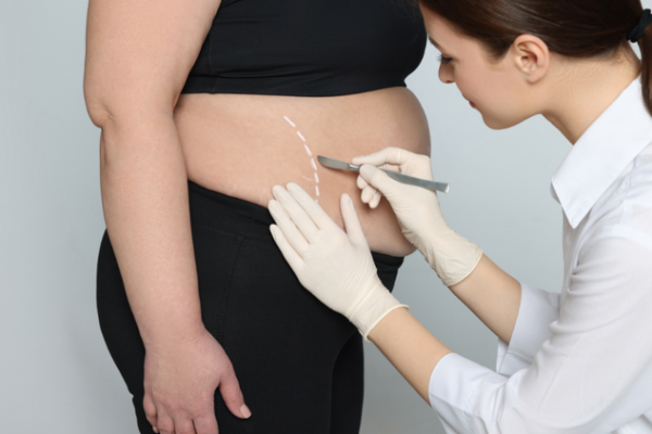 Gastric Botox in Abu Dhabi