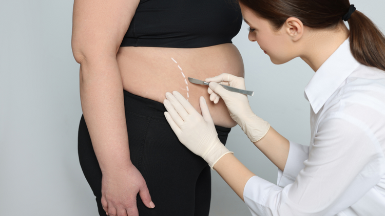 Gastric Botox in Abu Dhabi