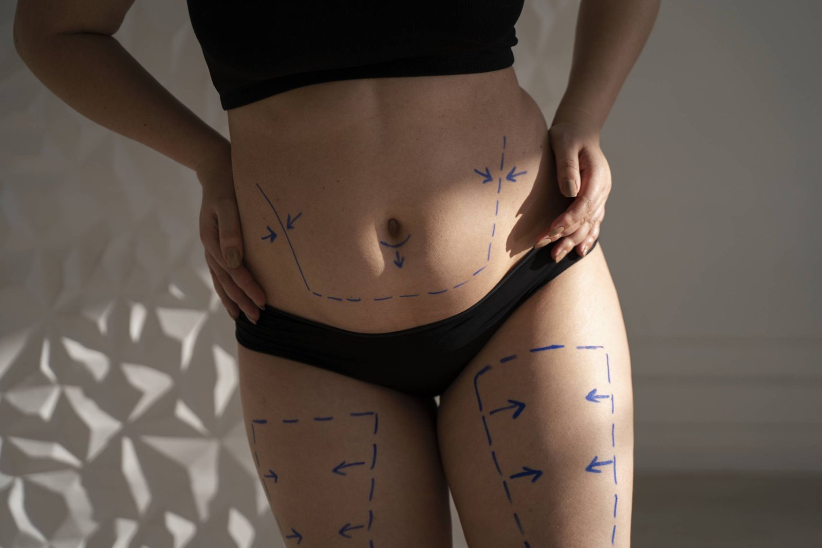 Mini gastric bypass in Abu Dhabi