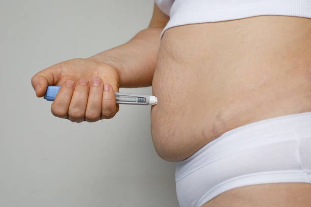 Who Can Consider Saxenda Injections for Weight Loss