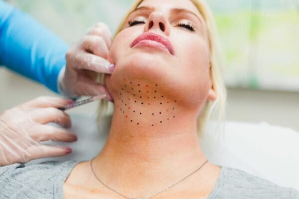 Double Chin Removal
