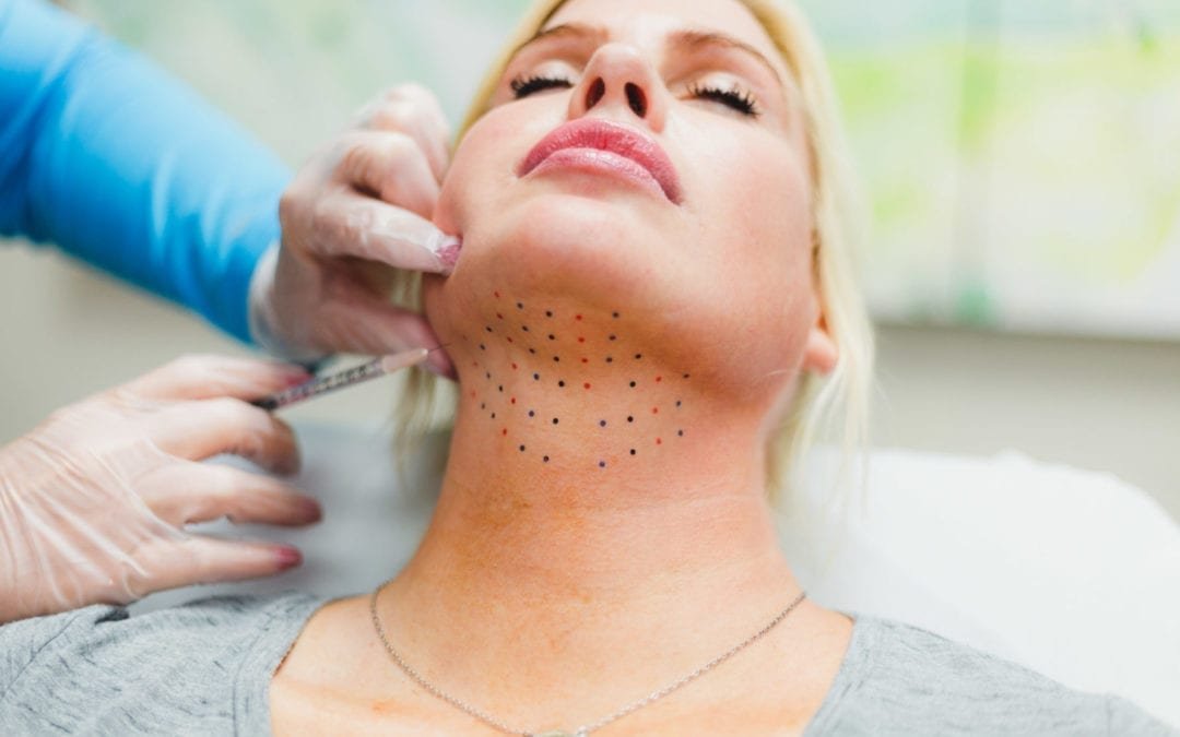 Double Chin Removal
