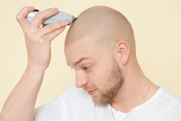 Scalp Micropigmentation Dubai