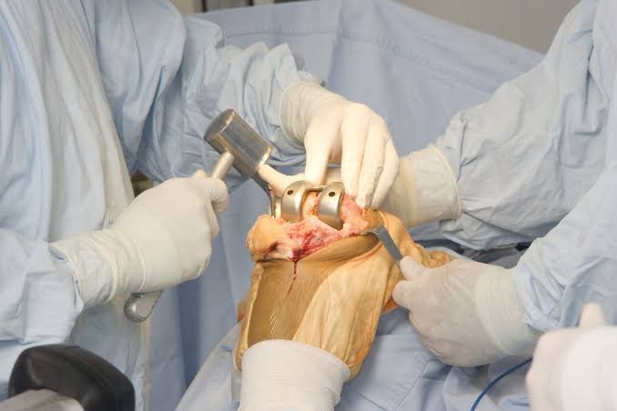 orthopaedic surgeons