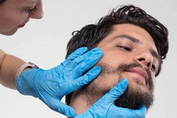 Beard Hair Transplant in Dubai