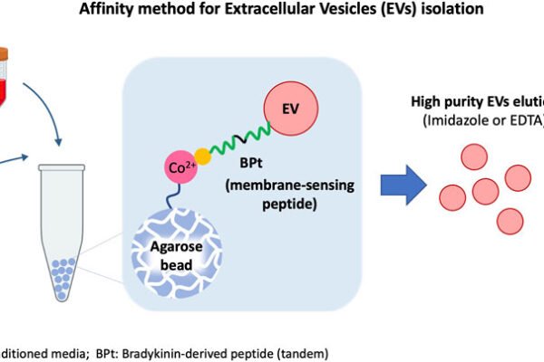 Endotoxin Removal Kit