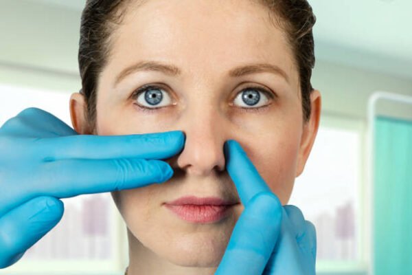 Can Closed Rhinoplasty Improve Facial Proportions
