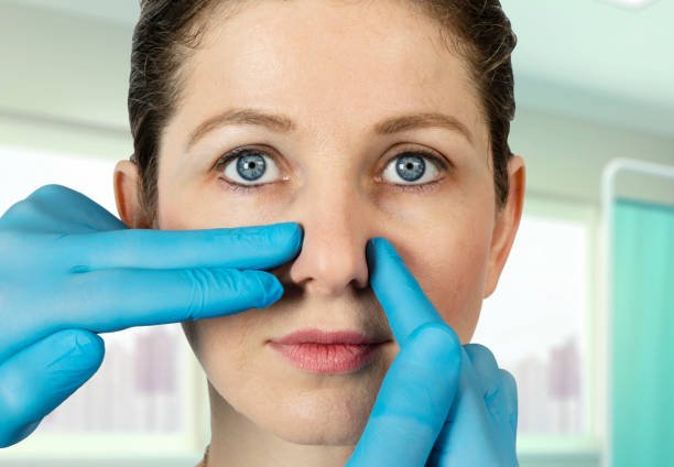 Can Closed Rhinoplasty Improve Facial Proportions