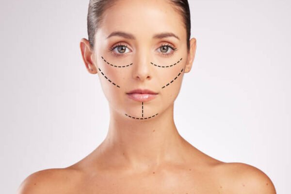 Can Facelifts be combined with fat transfer safely