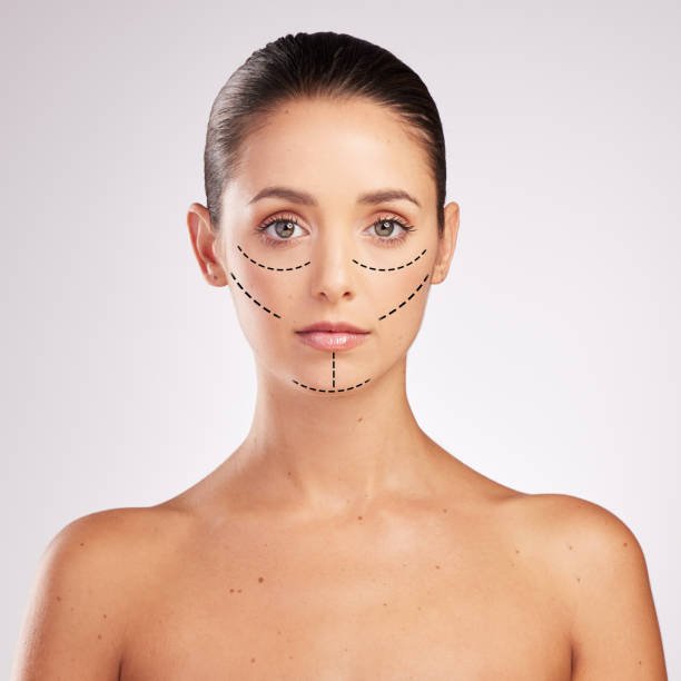 Can Facelifts be combined with fat transfer safely